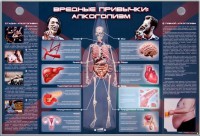 Электрифицированный стенд "Вредные привычки: алкоголизм" - fgospostavki.ru - Мурманск