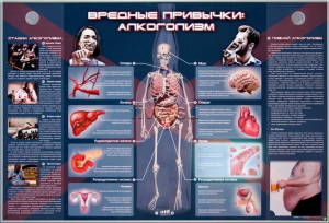 Электрифицированный стенд "Вредные привычки: алкоголизм" - fgospostavki.ru - Мурманск
